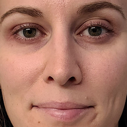 4-in-1 Skincare Wand